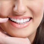Diseño de sonrisa Dra Rodríguez y su enfoque innovador para cuidar salud dental y estética facial